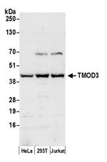 TMOD3 Polyclonal Antibody