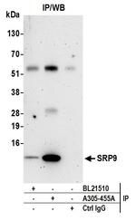 SRP9 Antibody in Immunoprecipitation (IP)