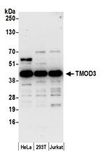 TMOD3 Polyclonal Antibody