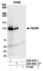 HAUS6 Antibody in Immunoprecipitation (IP)