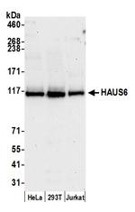 HAUS6 Polyclonal Antibody