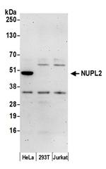 NUPL2 Polyclonal Antibody