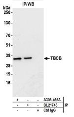 TBCB Antibody in Immunoprecipitation (IP)