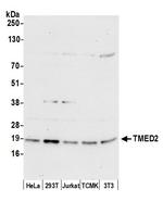 TMED2 Polyclonal Antibody