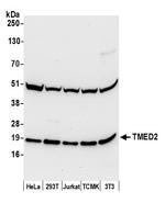 TMED2 Polyclonal Antibody