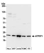 ATP5F1 Polyclonal Antibody