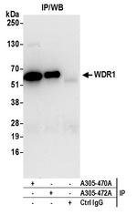 WDR1 Antibody in Immunoprecipitation (IP)