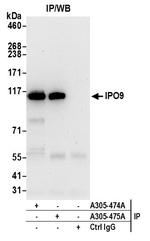 IPO9 Antibody in Immunoprecipitation (IP)