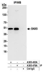 SNX5 Antibody in Immunoprecipitation (IP)