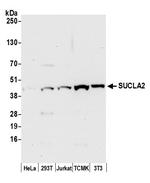 SUCLA2 Polyclonal Antibody