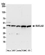 SUCLA2 Polyclonal Antibody