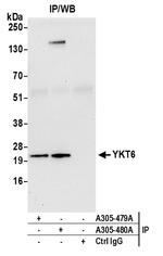 YKT6 Antibody in Immunoprecipitation (IP)