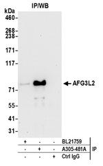 AFG3L2 Antibody in Immunoprecipitation (IP)