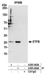 ETFB Polyclonal Antibody