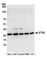 ETFB Polyclonal Antibody