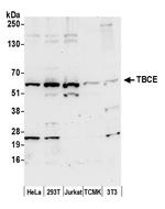 TBCE Polyclonal Antibody