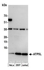 ATP5L Polyclonal Antibody