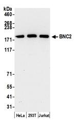 BNC2 Polyclonal Antibody
