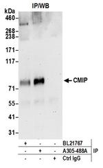 CMIP Polyclonal Antibody