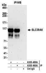 SLC39A6 Antibody in Immunoprecipitation (IP)