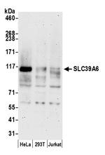 SLC39A6 Polyclonal Antibody