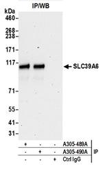 SLC39A6 Polyclonal Antibody