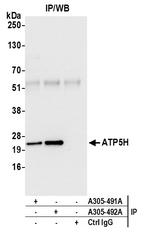 ATP5H Antibody in Immunoprecipitation (IP)