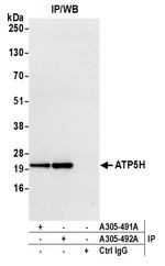 ATP5H Antibody in Immunoprecipitation (IP)