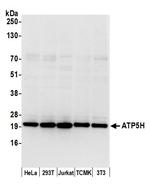 ATP5H Polyclonal Antibody