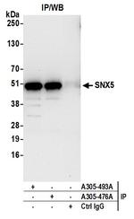 SNX5 Antibody in Immunoprecipitation (IP)