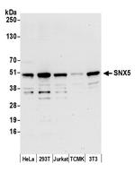 SNX5 Antibody in Western Blot (WB)