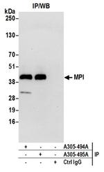 MPI Polyclonal Antibody