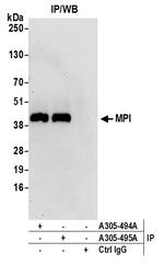 MPI Polyclonal Antibody