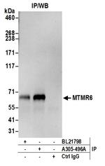MTMR6 Polyclonal Antibody