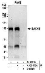 BACH2 Antibody in Immunoprecipitation (IP)