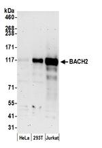 BACH2 Polyclonal Antibody