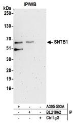 SNTB1 Antibody in Immunoprecipitation (IP)