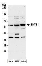SNTB1 Antibody in Western Blot (WB)