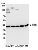 SRM Polyclonal Antibody