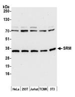 SRM Polyclonal Antibody