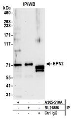 EPN2 Polyclonal Antibody