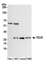 TECR Polyclonal Antibody