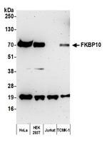 FKBP10 Polyclonal Antibody