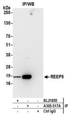 REEP5 Antibody in Immunoprecipitation (IP)