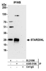 STARD3NL Antibody in Immunoprecipitation (IP)
