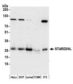 STARD3NL Polyclonal Antibody