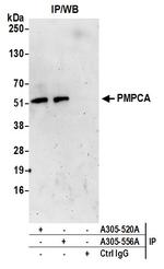 PMPCA Antibody in Immunoprecipitation (IP)