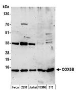COX5B Polyclonal Antibody