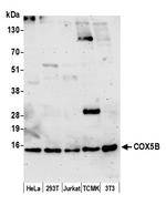 COX5B Polyclonal Antibody