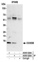 COX5B Polyclonal Antibody